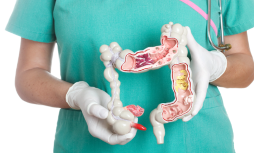 How Colorectal Cancer Surgery Can Improve Your Quality of Life How Colorectal Cancer Surgery Can Improve Your Quality of Life